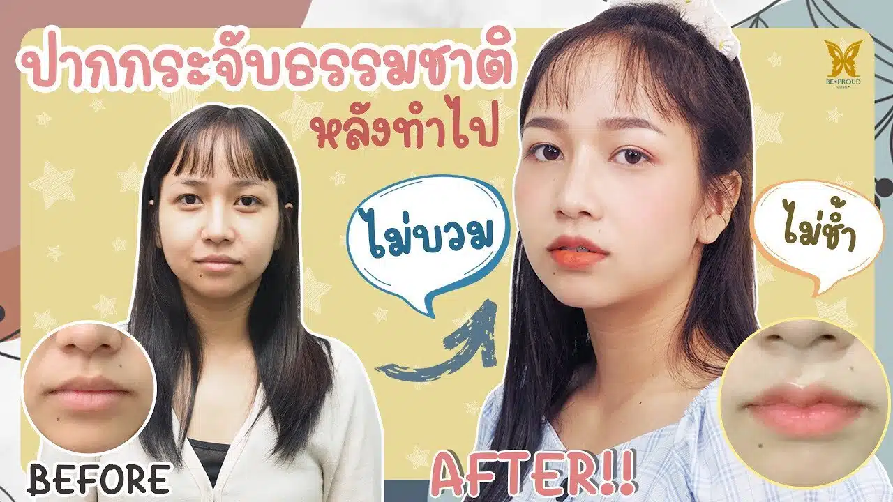 รีวิวปากกระจับ