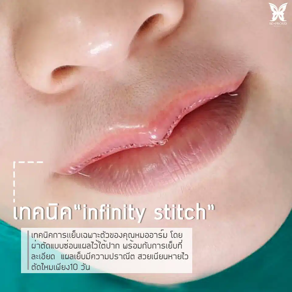 เรื่องควรรู้ก่อนทำปากกระจับ2 infinity stitch