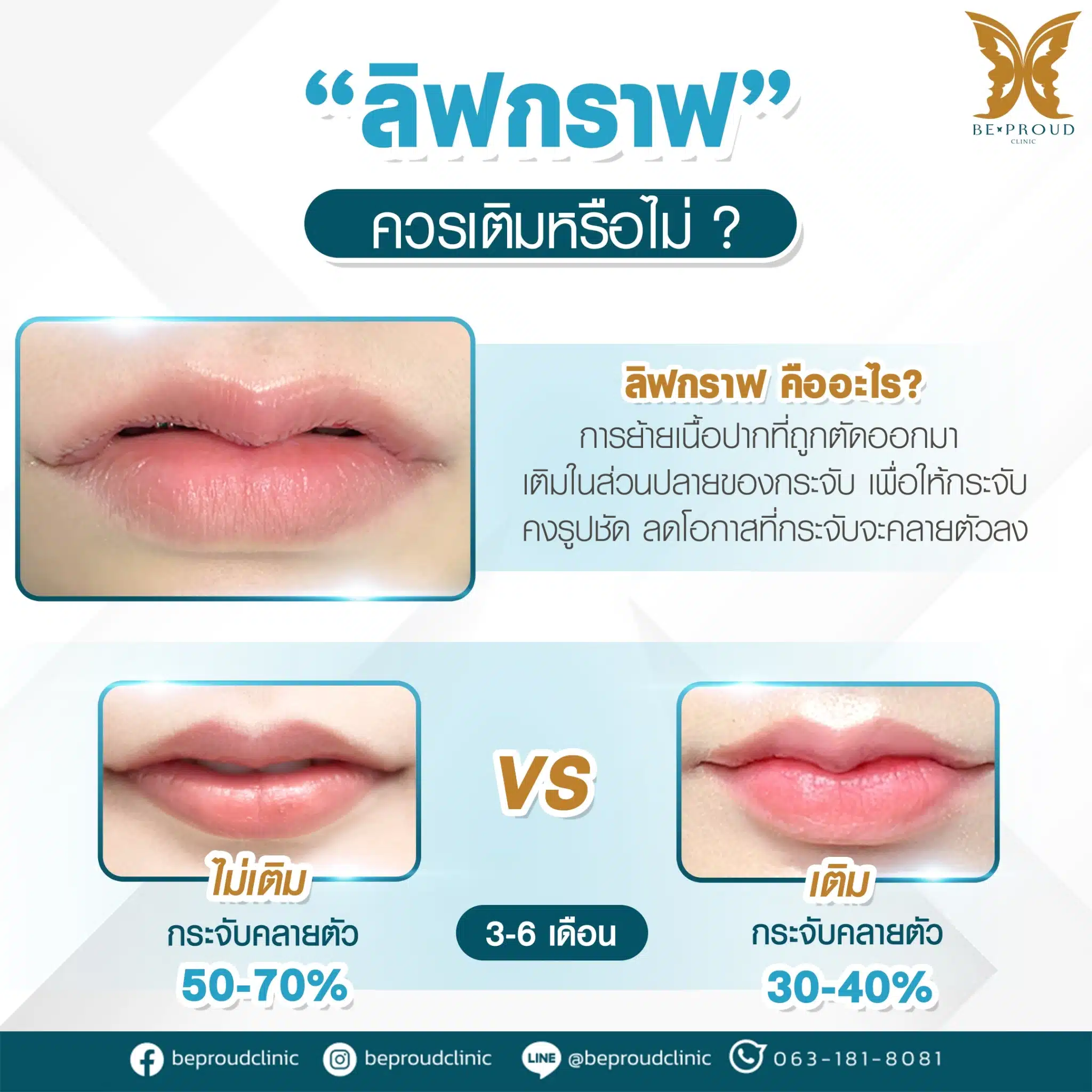 ลิปกราฟคืออะไร