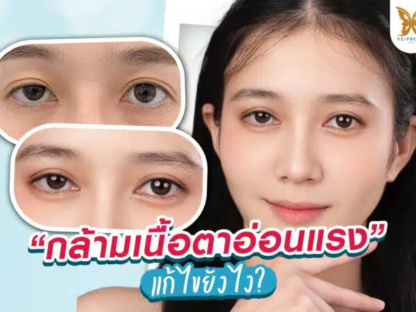 เป็นกล้ามเนื้อตาอ่อนแรง แก้ไขยังไง?