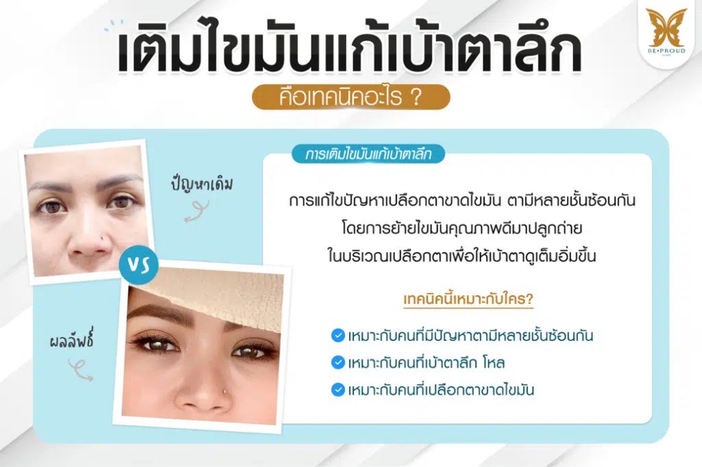 หมอดา ศัลยกรรมตกแต่งใบหน้า (Plastic Surgery)